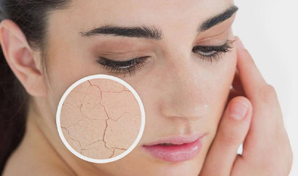 Gel giúp giảm giãn mao mạch Dr Spiller Anti Couperose Gel