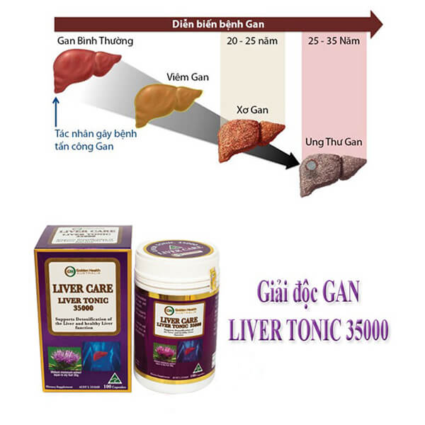 Viên uống bổ gan Golden Health Liver Care Liver Tonic