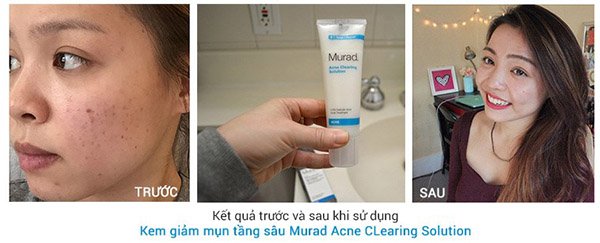 Murad Acne CLearing Solution Pro