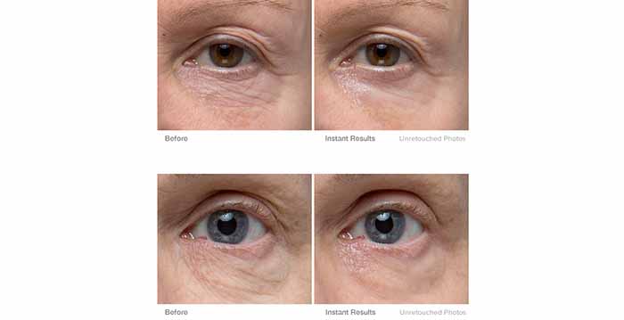 Murad Renewing Eye Cream 15ml 3