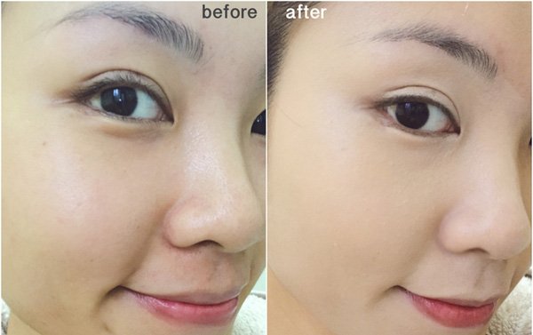 Dermalogica Daily Microfoliant