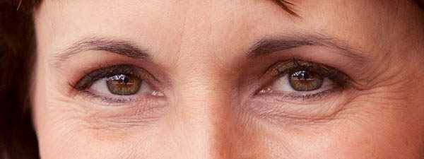 Dermalogica Intensive Eye Repair