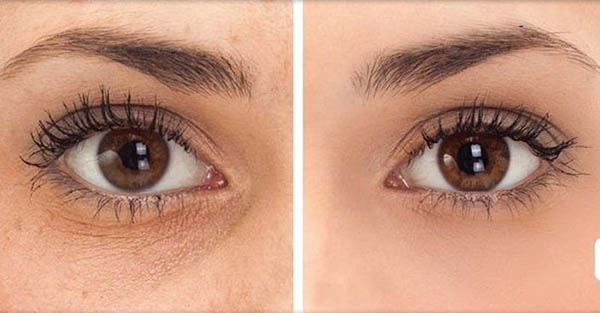 Dermalogica Intensive Eye Repair