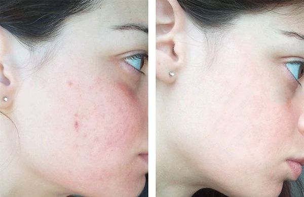 Dermalogica Oil Free Matte