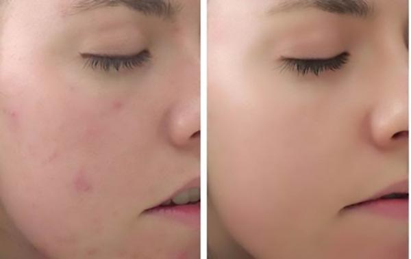 Dermalogica Sebum Clearing Masque