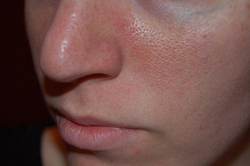Dermalogica Skin Refining Masque