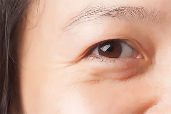Dermalogica Total Eye Care SPF15