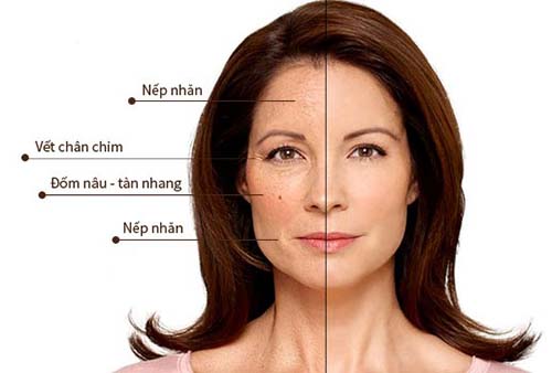 Kem chống lão hóa dành cho da khô Image Skincare Ageless Total Repair Crème