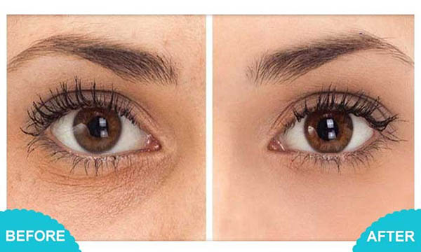 Serum giảm nhăn, trị quầng thâm vùng mắt Obagi Professional C Eye Brightener Serum 15ml