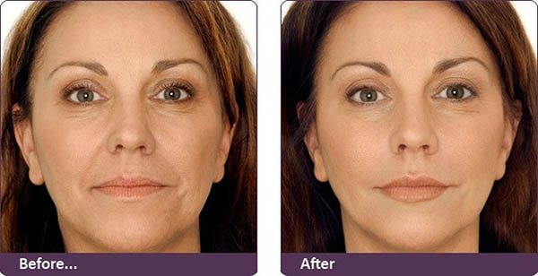 professional c peptide complex