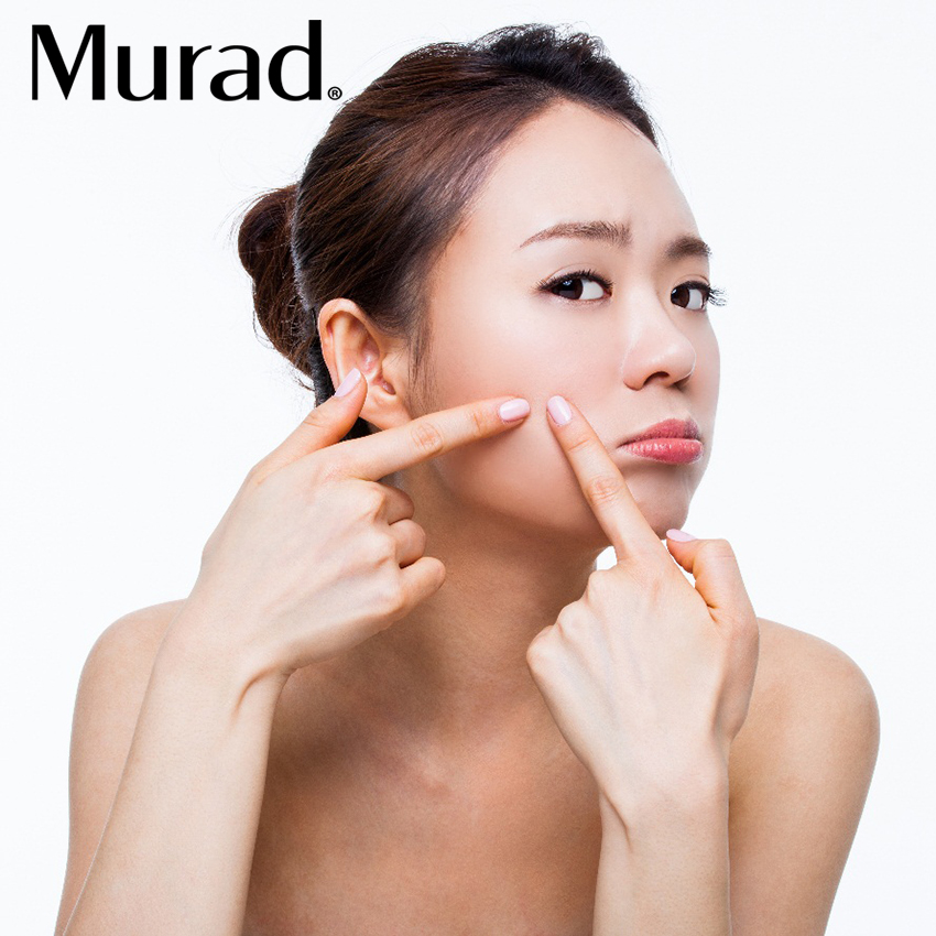 Murad Advanced Blemish & Wrinkle Reducer 30ml - Serum giúp giảm mụn chống lão hóa cao cấp Hoa Kỳ