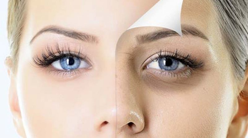 Kem trị bọng mắt, thâm quầng mắt Obagi ELASTIderm Eye Treatment Cream 15g – Giữ gìn đôi mắt sáng ngời tinh anh