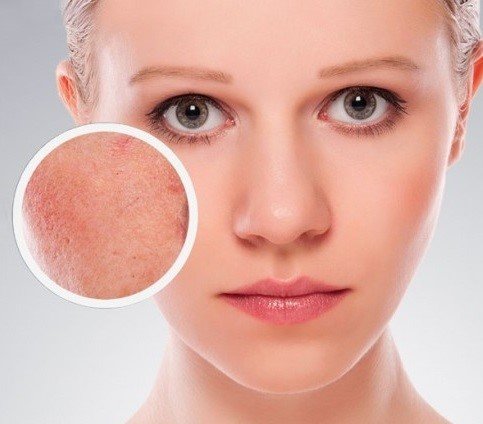 Kem dưỡng ẩm làm dịu da tức thì Mesoestetic Fast Skin Repair 50ml dành cho da nhạy cảm được ưa chuộng số 1 tại Tây Ban Nha