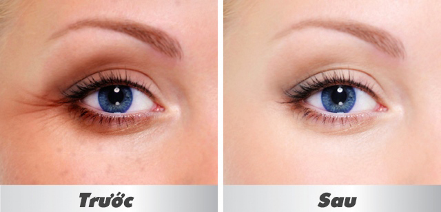 Babor SE Anti-Wrinkle Eye Fluid 15ml – Tinh chất chống nhăn vùng mắt được yêu thích hàng đầu tại Đức