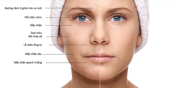 Những dấu hiệu cho thấy da cần bổ sung collagen.