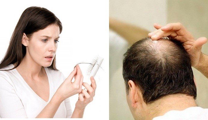 Maxroot Cosmetic Scalp Hair Root Massage Gel – Gel kích thích mọc tóc và điều trị tóc bạc bán chạy hàng đầu tại Nhật Bản