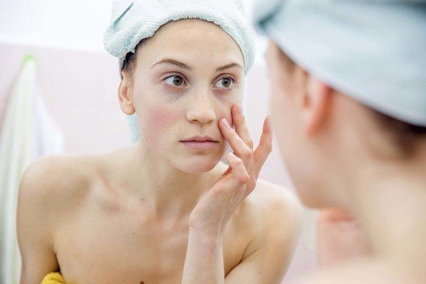 Vào mùa đông, chăm sóc da nhạy cảm như thế nào?