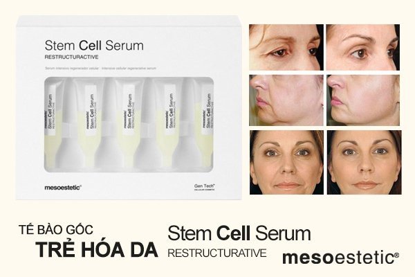 Serum tế bào gốc trẻ hóa da Mesoestetic Stem Cell Serum Restructurative (5 tuýp x 3ml) – Tây Ban Nha