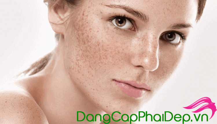 Collagen nhật bản trị mụn