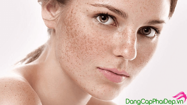 collagen trị nám nhật bản
