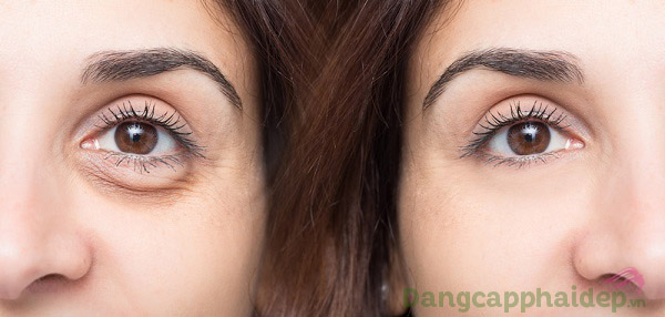 Trước và sau khi sử dụng Skincode Cellular Wrinkle Prohibiting Eye Contour Cream