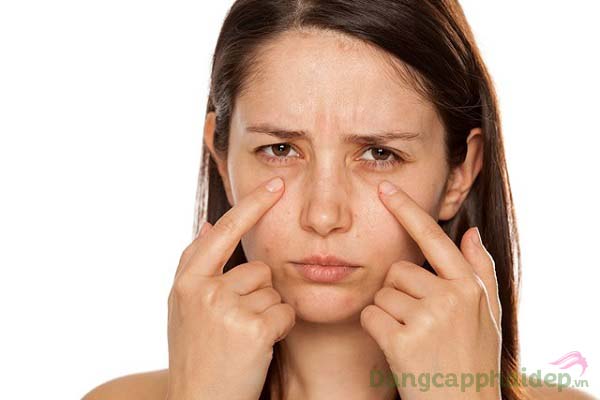 Gương mặt kém sắc vì mắt thâm quầng, nếp nhăn...