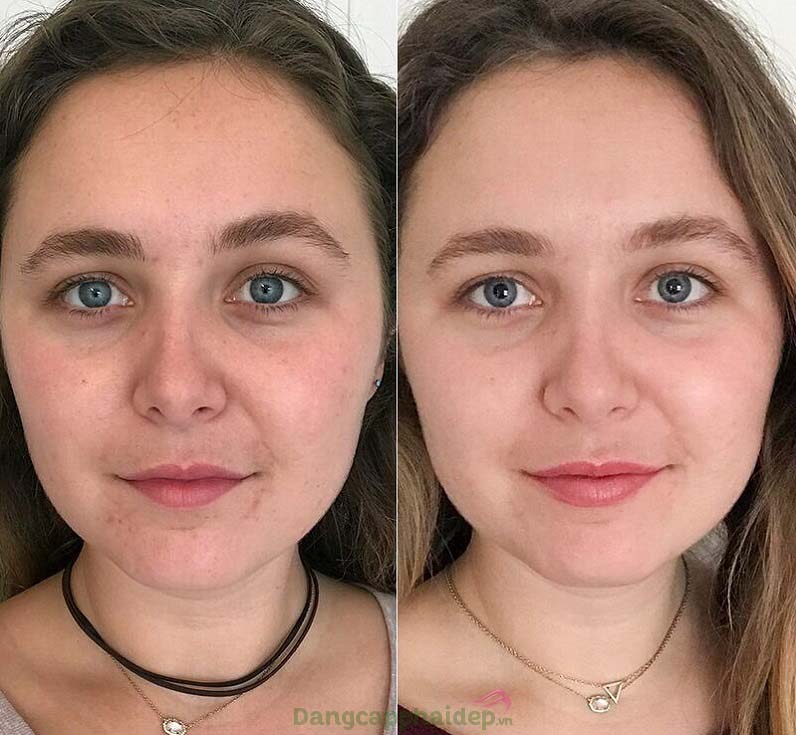 Hình ảnh trước và sau khi sử dụng sản phẩm