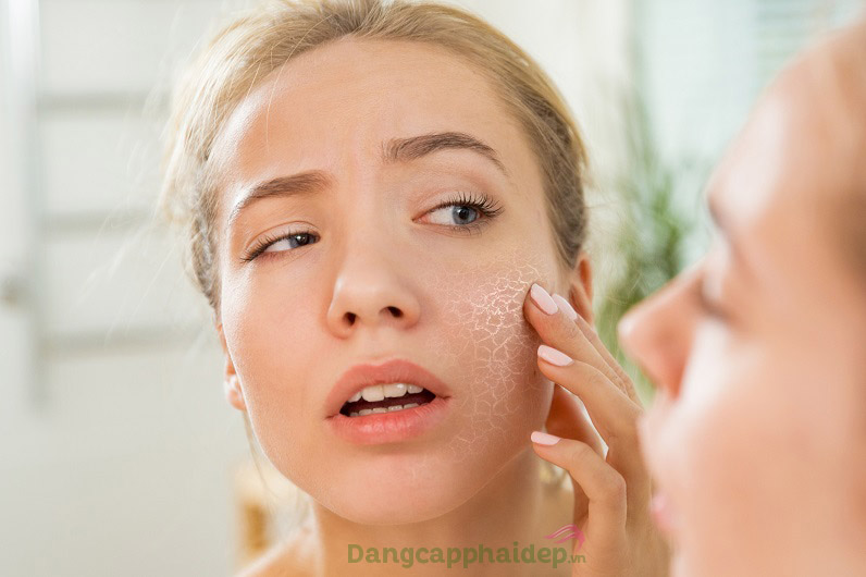 Sản phẩm dành cho làn da khô sần, nứt nẻ do thiếu ẩm, mất nước