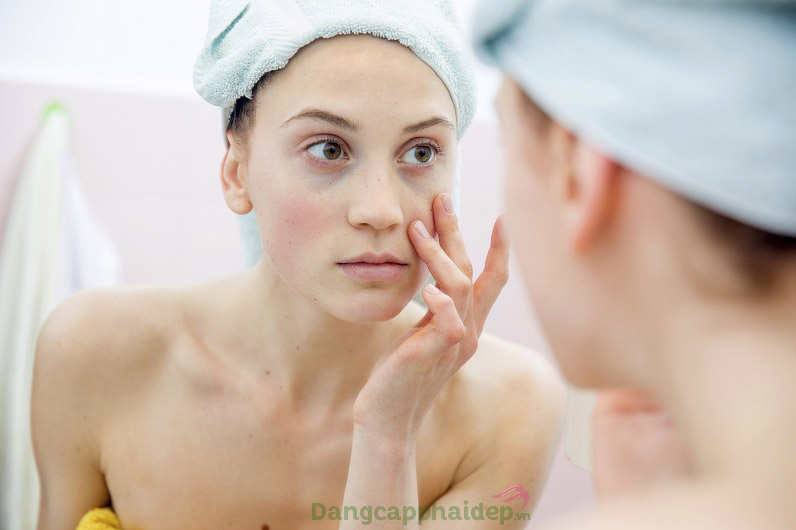 Sử dụng kem dưỡng ngay khi da có dấu hiệu ửng đỏ, sưng viêm khó chịu