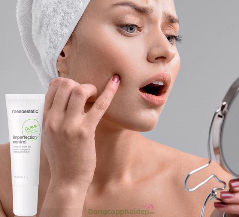 Trị mụn cấp tốc, che phủ nhanh các nốt mụn trên da với Mesoestetic Imperfection Control