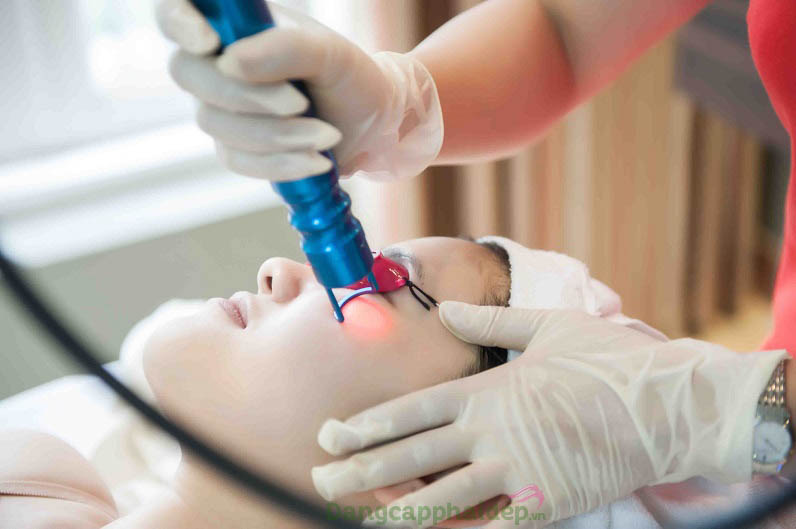 Chăm sóc da trước điều trị laser là bước quan trọng không nên lơ là