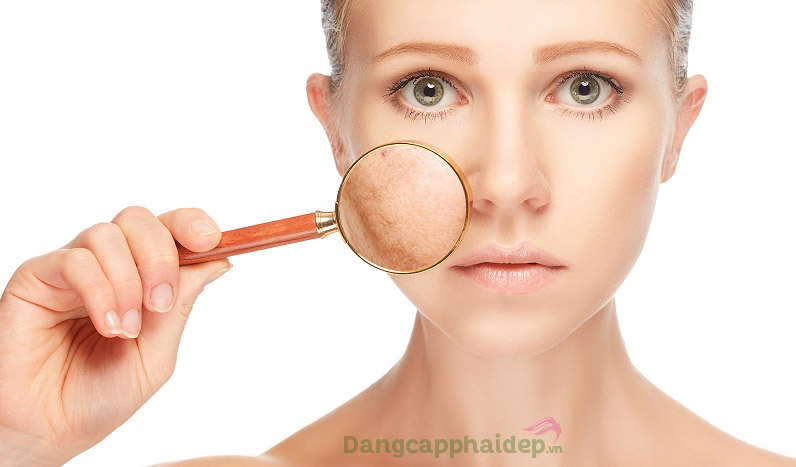 Bộ sản phẩm thiết kế dành cho da thường đến da khô; da sạm nám, tông màu da không đều...