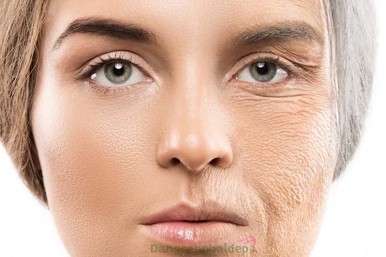 Thiếu hụt collagen theo thời gian, da chảy xệ, lỏng lẻo nhăn nheo...