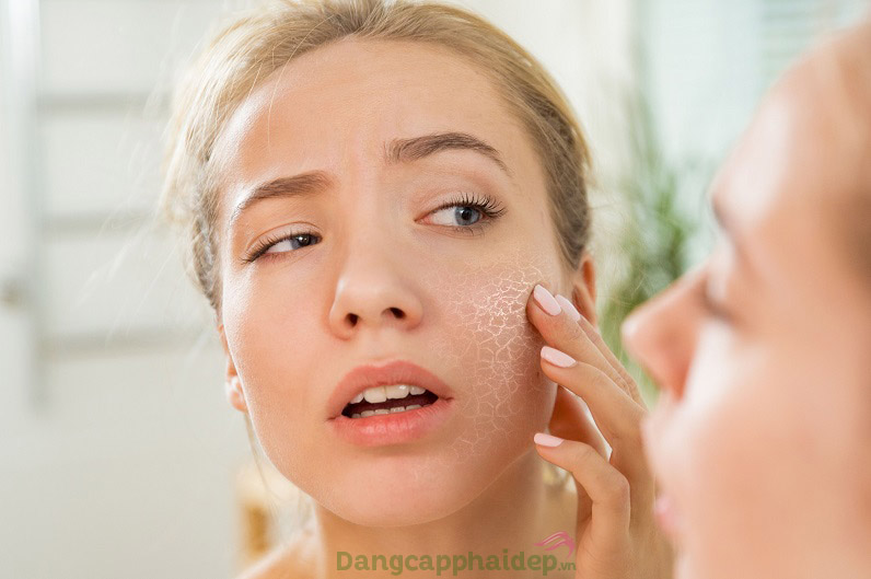 Da khô nứt là biểu hiện của việc thiếu ẩm, mất nước trên da