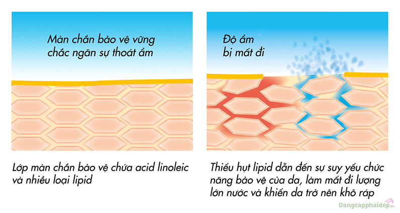 Thiếu hụt lipid dẫn đến chức năng bảo vệ da bị suy yếu.