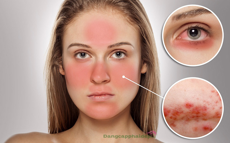Sữa rửa mặt Obagi Gentle Rejuvenation Soothing Cleanser