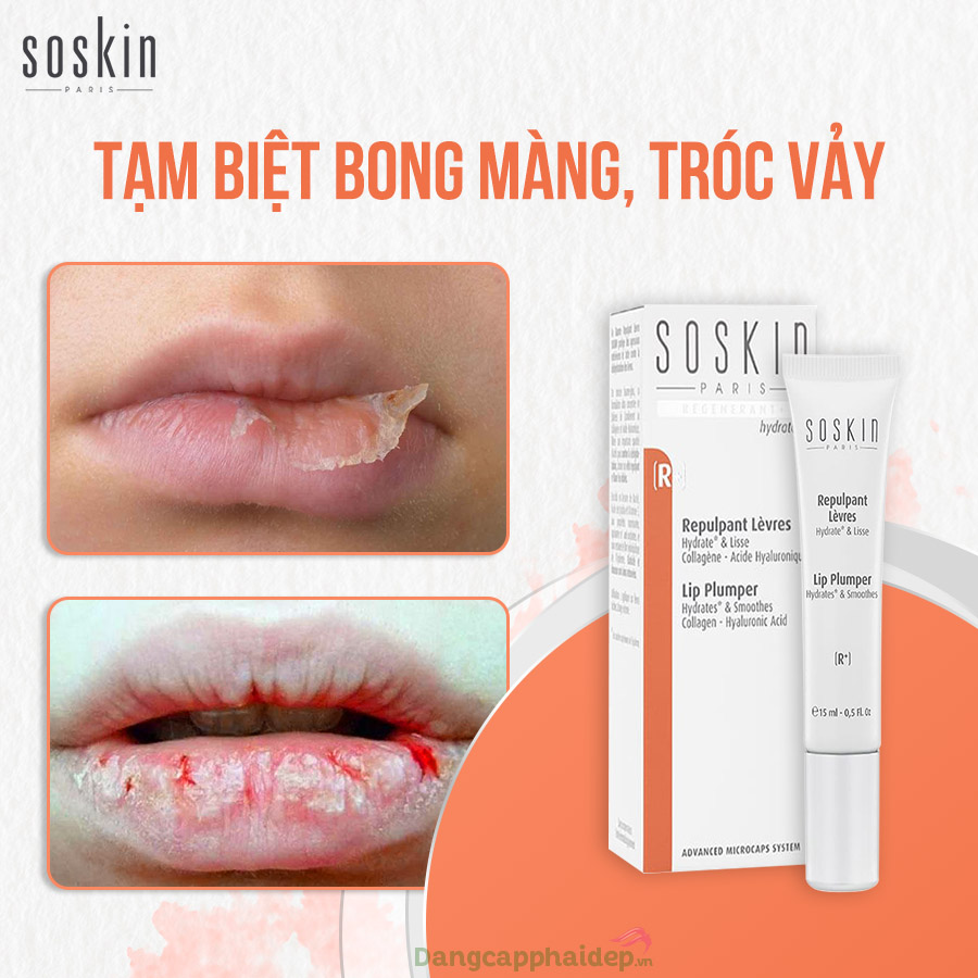 Soskin Lip Plumper là giải pháp dưỡng da tốt nhất cho đôi môi khô nứt, bong màng hay tróc vảy...