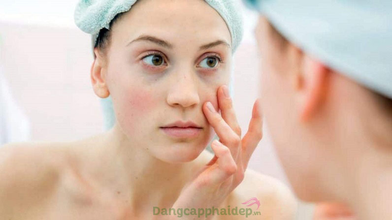 Tác dụng phụ của collagen có thể gây mẫn cảm trên da