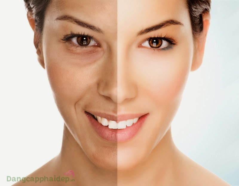 MartiDerm Black Diamond Skin Complex Advanced