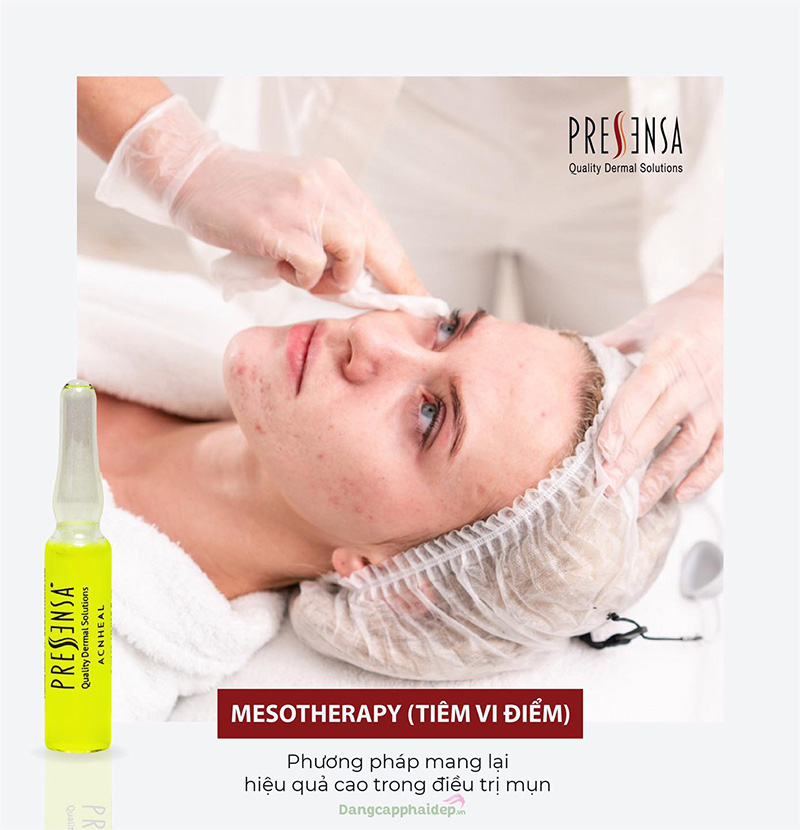 Pressensa AcnHeal - Mesotherapy phương pháp điều trị mụn hiệu quả cao.