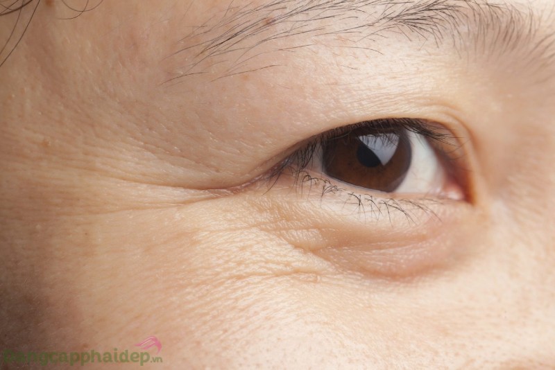 Zo Skin Health Growth Factor Eye Serum