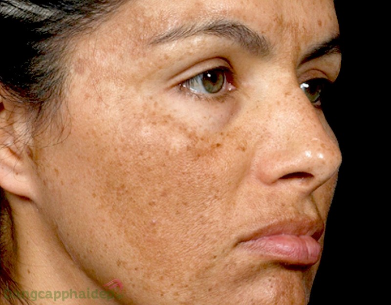 Zo Skin Health Pigment Control + Blending Crème