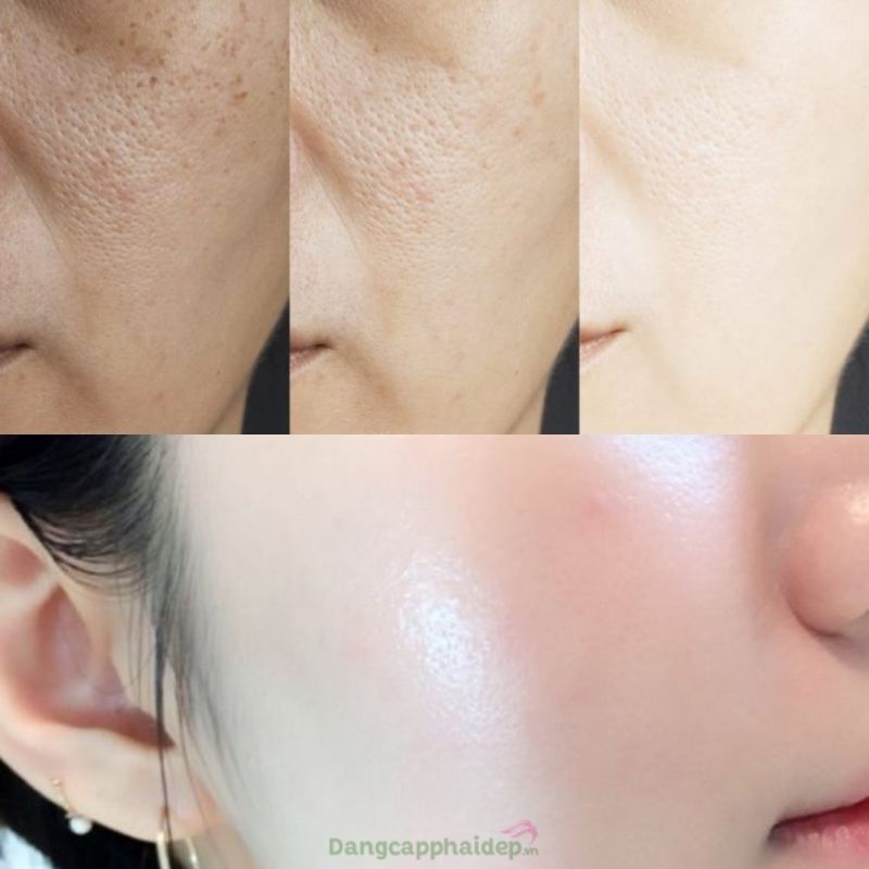 Những công dụng nổi bật của Zo Skin Health Instant Pore Refiner.