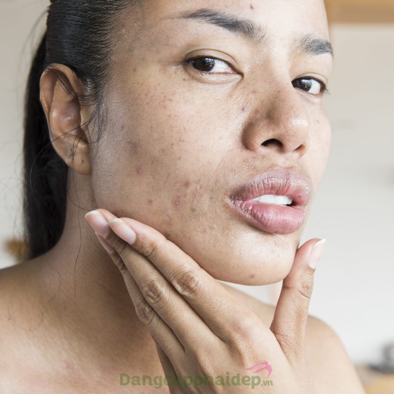 Babor Skinovage Purifying Cream Rich
