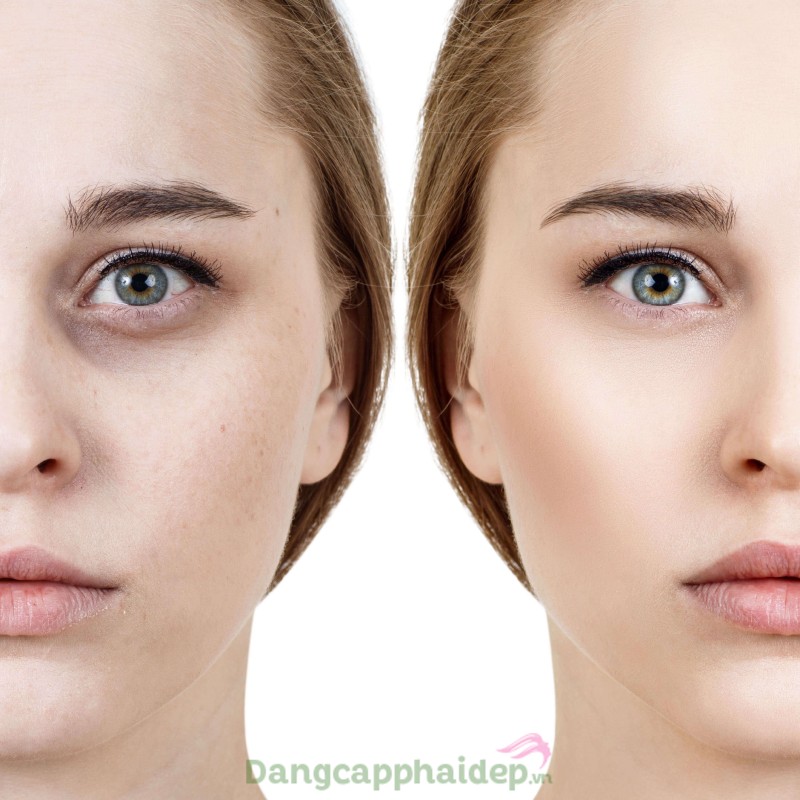 Babor Skinovage Vitalizing Eye Cream